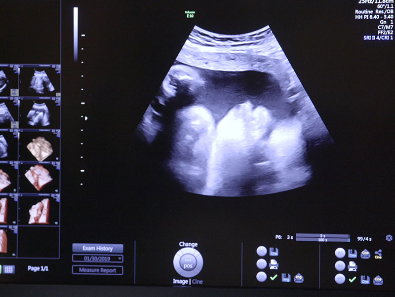 Luchando contra la adicción y enfrentando un embarazo no planeado, una madre expectante eludió una clínica de aborto, visitó un centro de recursos para el embarazo y dio a su criatura en adopción.